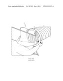 Culvert Gate Assembly diagram and image