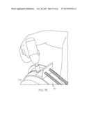 Culvert Gate Assembly diagram and image