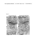 DIFFERENTIATION OF HUMAN EMBRYONIC AND INDUCED PLURIPOTENT STEM CELLS diagram and image