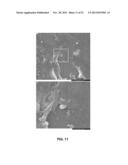 GENERATION OF NOVEL BONE FORMING CELLS (MONOOSTEOPHILS) FROM LL-37 TREATED     MONOCYTES diagram and image