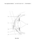 PARTICLES, COMPOSITIONS AND METHODS FOR OPHTHALMIC AND/OR OTHER     APPLICATIONS diagram and image