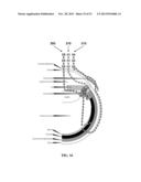 PARTICLES, COMPOSITIONS AND METHODS FOR OPHTHALMIC AND/OR OTHER     APPLICATIONS diagram and image