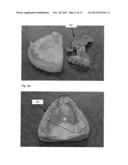 MODELING AND MANUFACTURING OF DENTURES diagram and image