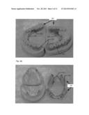 MODELING AND MANUFACTURING OF DENTURES diagram and image