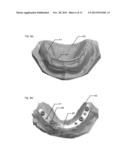 MODELING AND MANUFACTURING OF DENTURES diagram and image