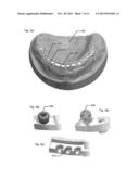 MODELING AND MANUFACTURING OF DENTURES diagram and image