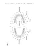 ARTIFICIAL MOLAR TEETH diagram and image