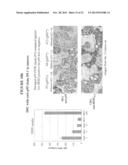 Methods and Assays for Measuring p95 and/or p95 Complexes in a Sample and     Antibodies Specific for p95 diagram and image