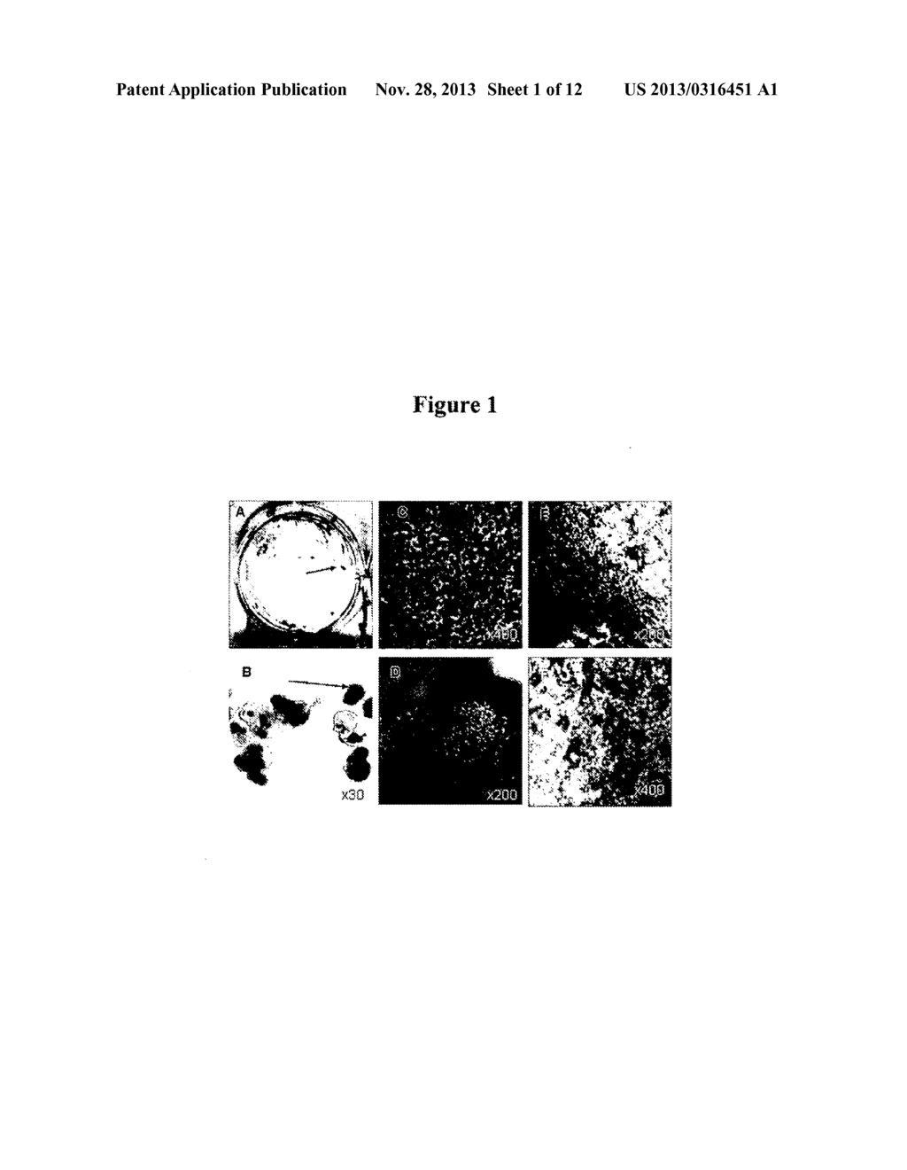 Modalities for the treatment of degenerative diseases of the retina - diagram, schematic, and image 02