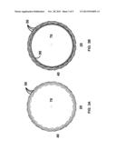 TAMPER-RESISTANT BALL BAT diagram and image