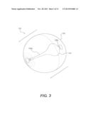 EXERCISE DEVICE WITH SUSPENDED INERTIAL CORE diagram and image