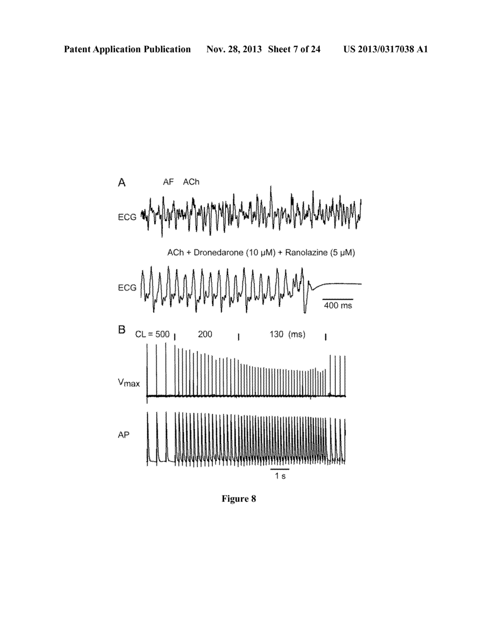 METHOD OF TREATING ATRIAL FIBRILLATION - diagram, schematic, and image 08