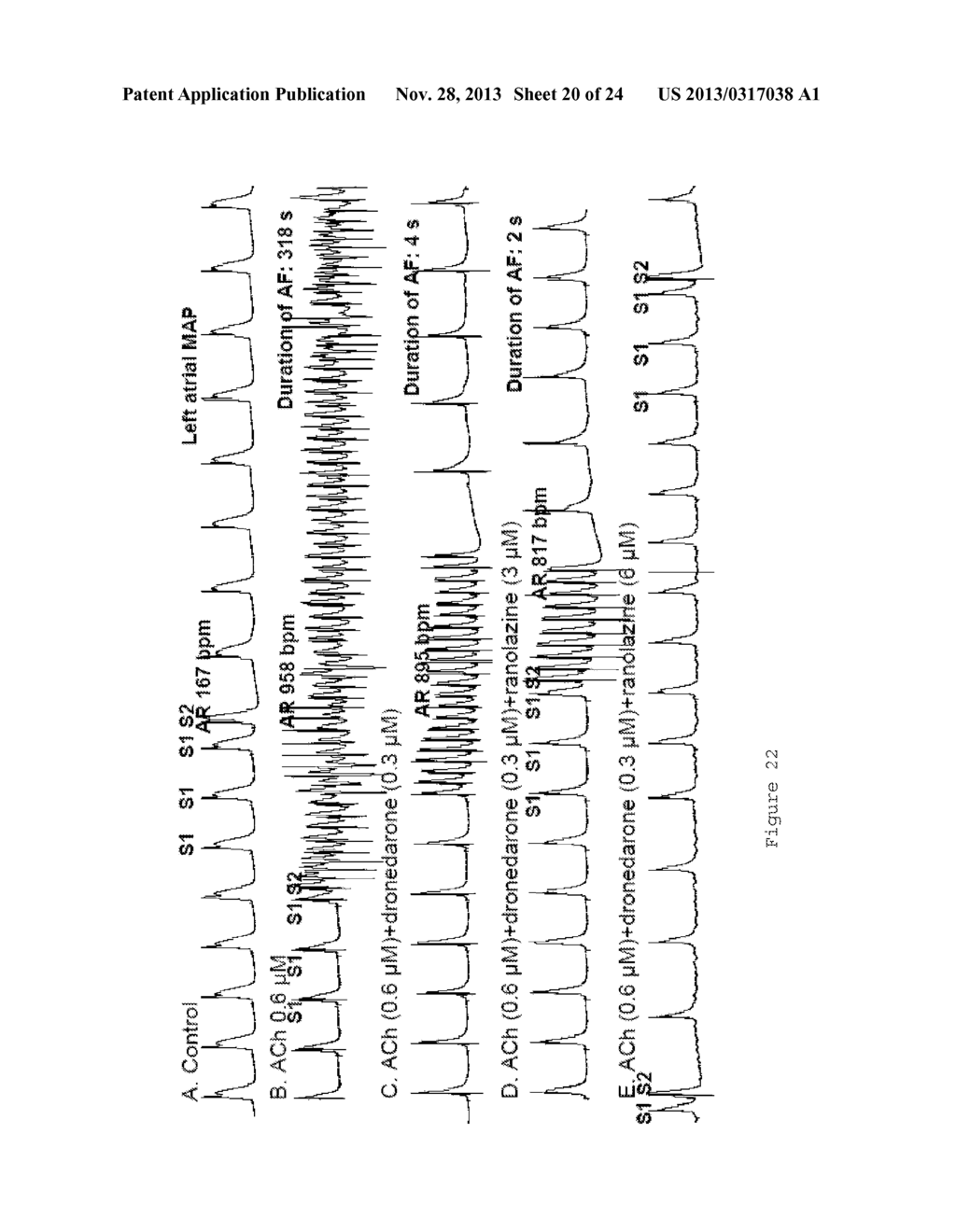 METHOD OF TREATING ATRIAL FIBRILLATION - diagram, schematic, and image 21