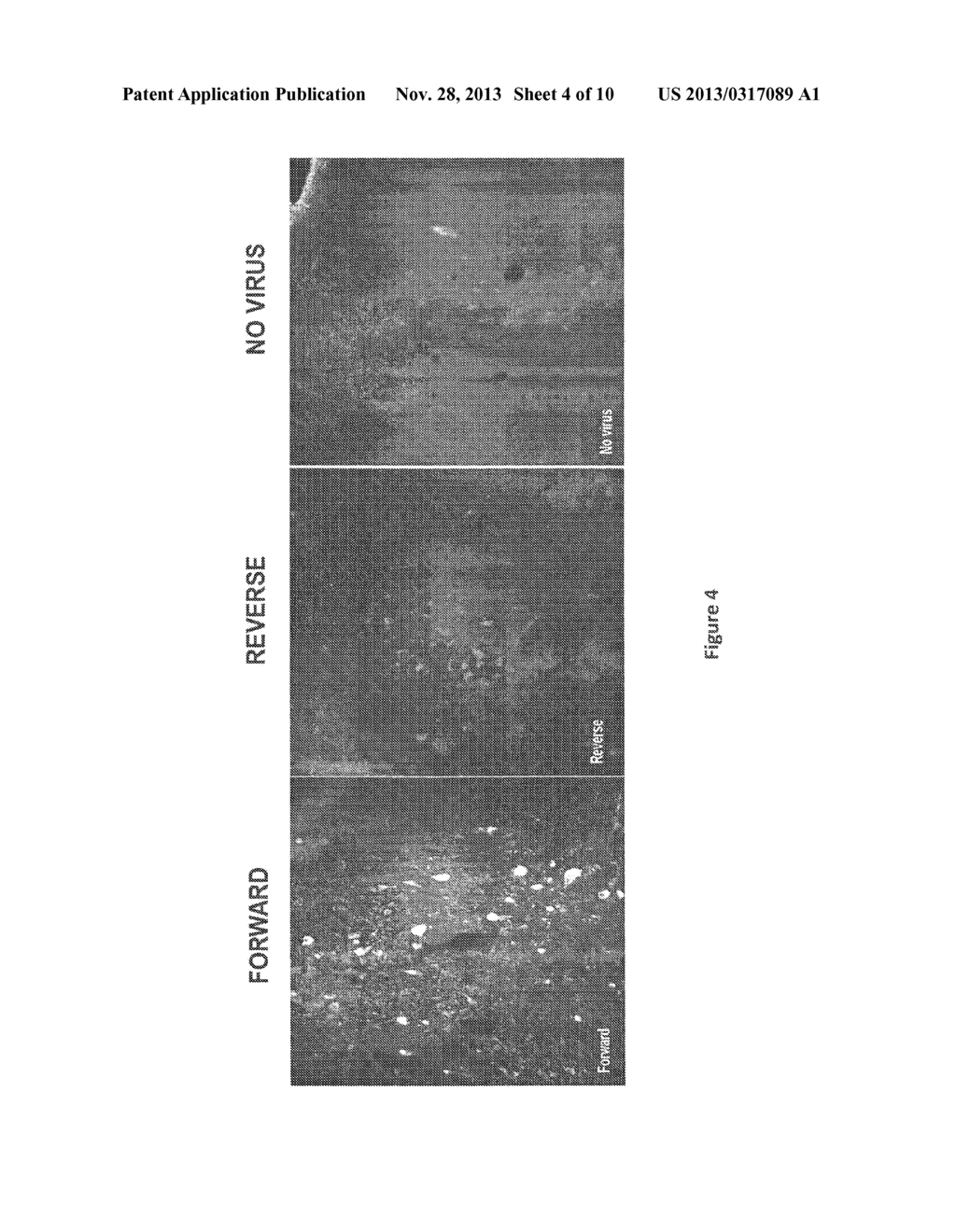 Compositions and Methods Useful for Treatment and Prevention of     Incontinence - diagram, schematic, and image 05