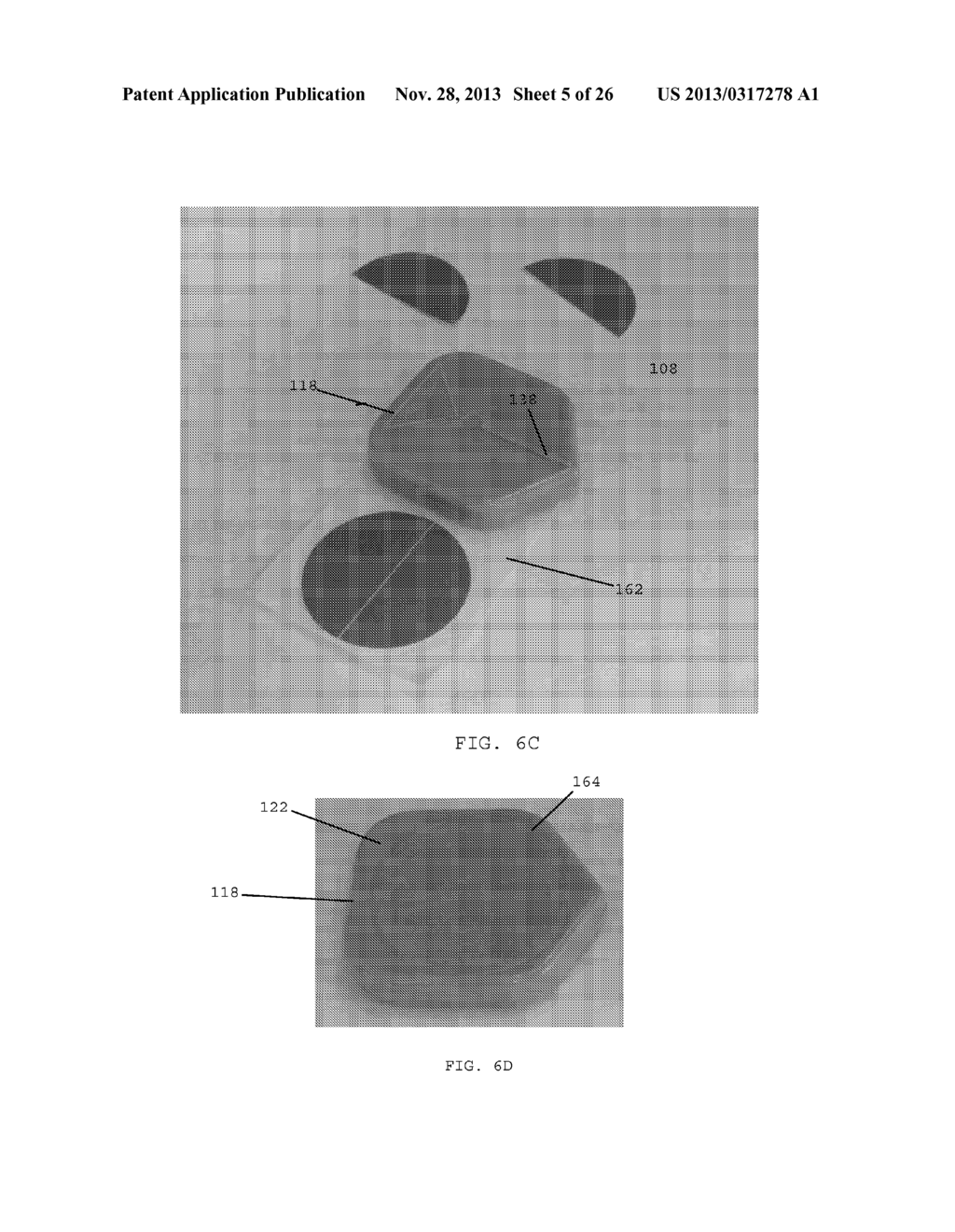 MULTI-POLAR MAGNETIC DEVICES FOR TREATING PATIENTS AND METHODS THEREFOR - diagram, schematic, and image 06