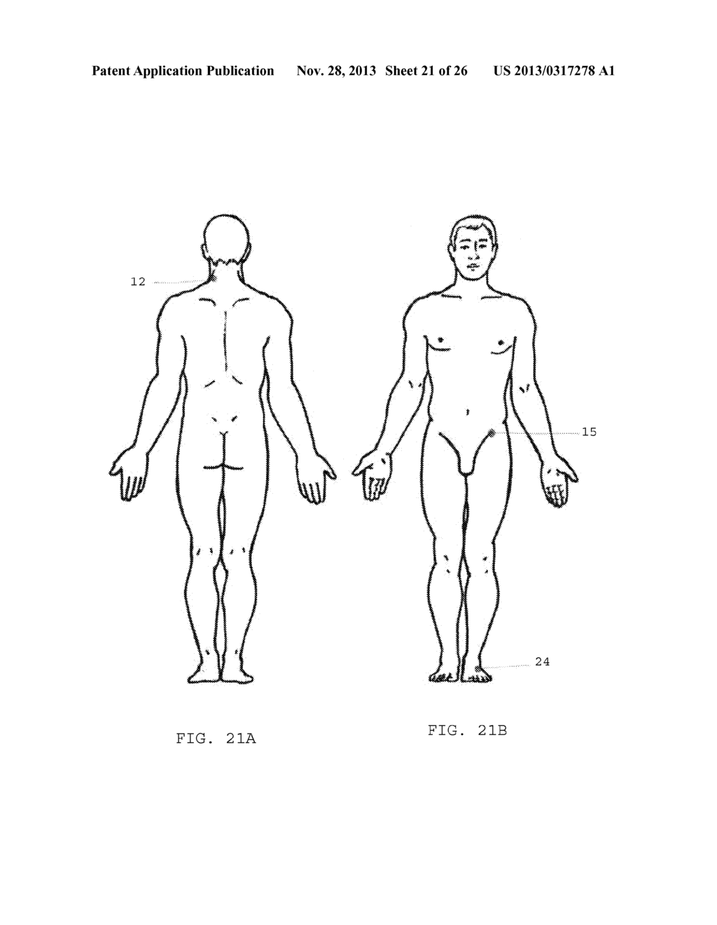 MULTI-POLAR MAGNETIC DEVICES FOR TREATING PATIENTS AND METHODS THEREFOR - diagram, schematic, and image 22