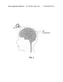 Method for Non-Invasive Brain Stimulation diagram and image