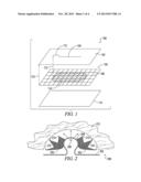 ANTI-EROSION SORFT TISSUE REPAIR DEVICE diagram and image