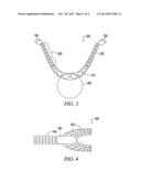 ANTI-EROSION SORFT TISSUE REPAIR DEVICE diagram and image