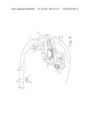 VAGINAL MANIPULATOR INCLUDING INDEX diagram and image