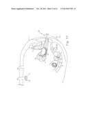 VAGINAL MANIPULATOR INCLUDING INDEX diagram and image