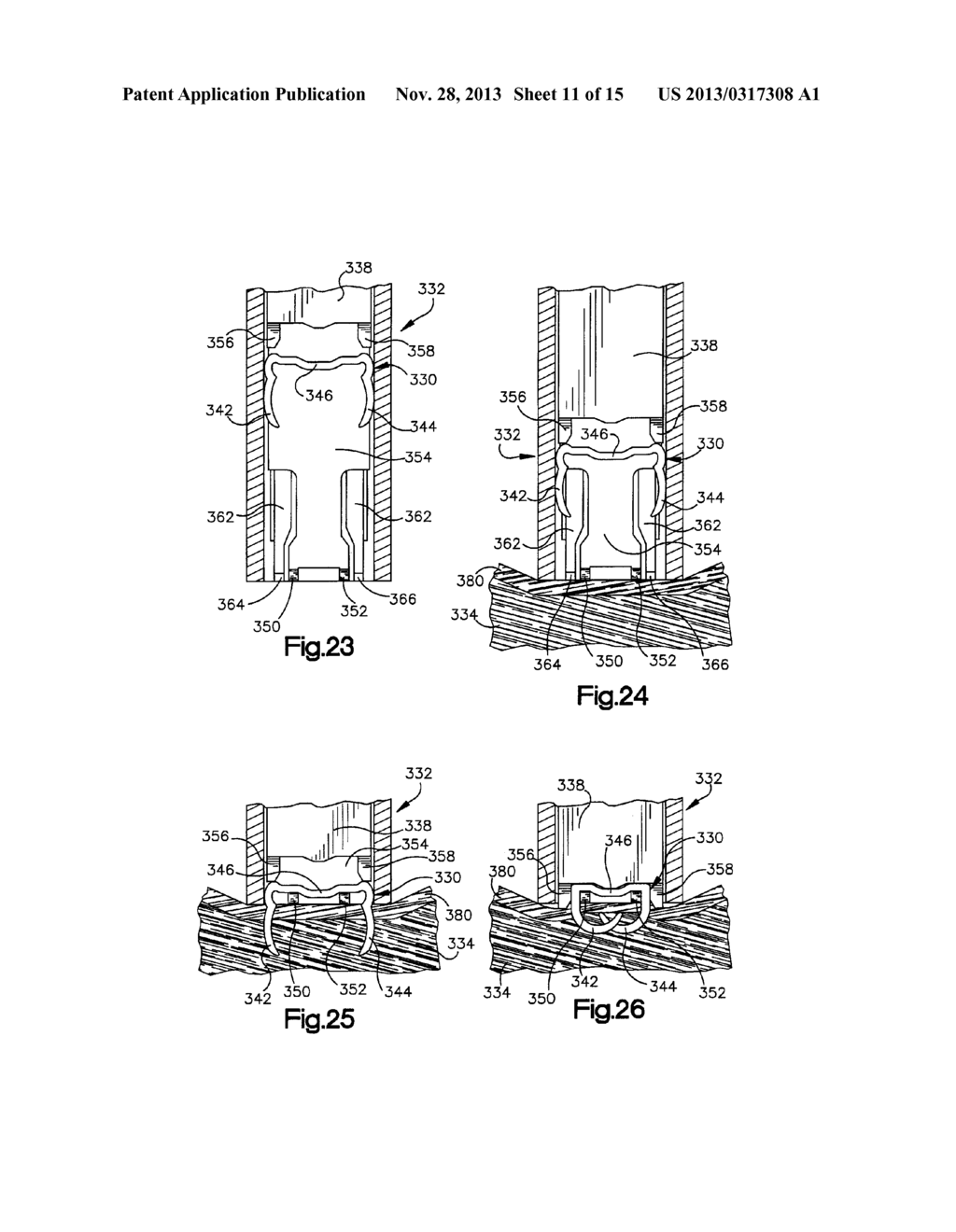 ROBOTIC RETRACTOR SYSTEM - diagram, schematic, and image 12