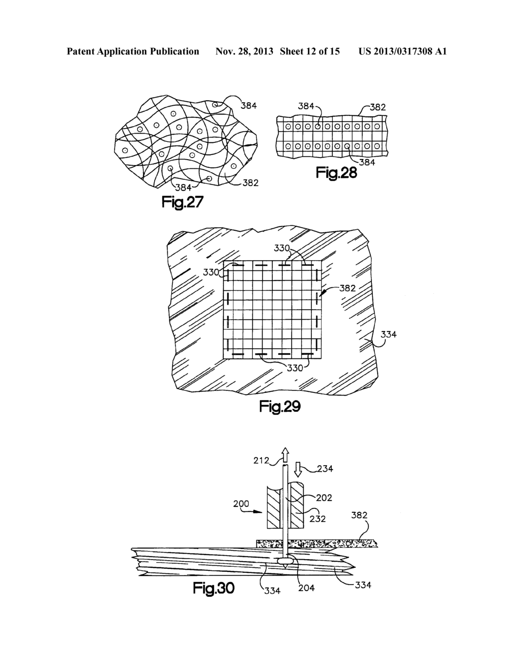 ROBOTIC RETRACTOR SYSTEM - diagram, schematic, and image 13