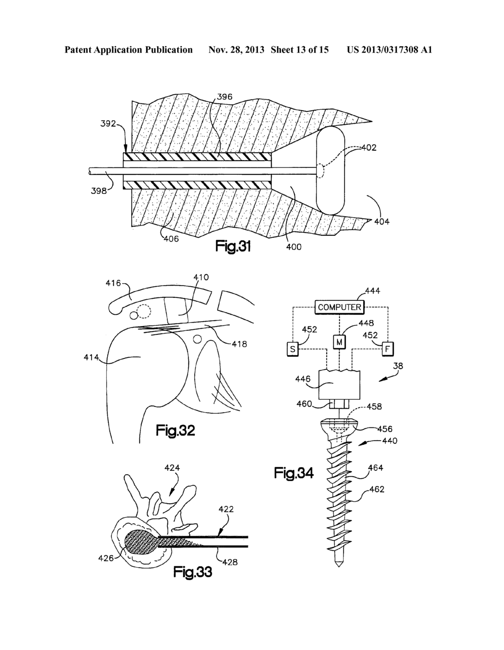 ROBOTIC RETRACTOR SYSTEM - diagram, schematic, and image 14