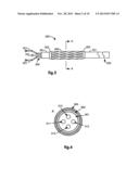 RETRACTION OF TISSUE FOR SINGLE PORT ENTRY, ROBOTICALLY ASSISTED MEDICAL     PROCEDURES diagram and image