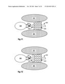 RETRACTION OF TISSUE FOR SINGLE PORT ENTRY, ROBOTICALLY ASSISTED MEDICAL     PROCEDURES diagram and image