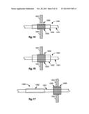 RETRACTION OF TISSUE FOR SINGLE PORT ENTRY, ROBOTICALLY ASSISTED MEDICAL     PROCEDURES diagram and image