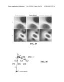 Continuous Modeling for Dipole Localization from 2D MCG Images with     Unknown Depth diagram and image