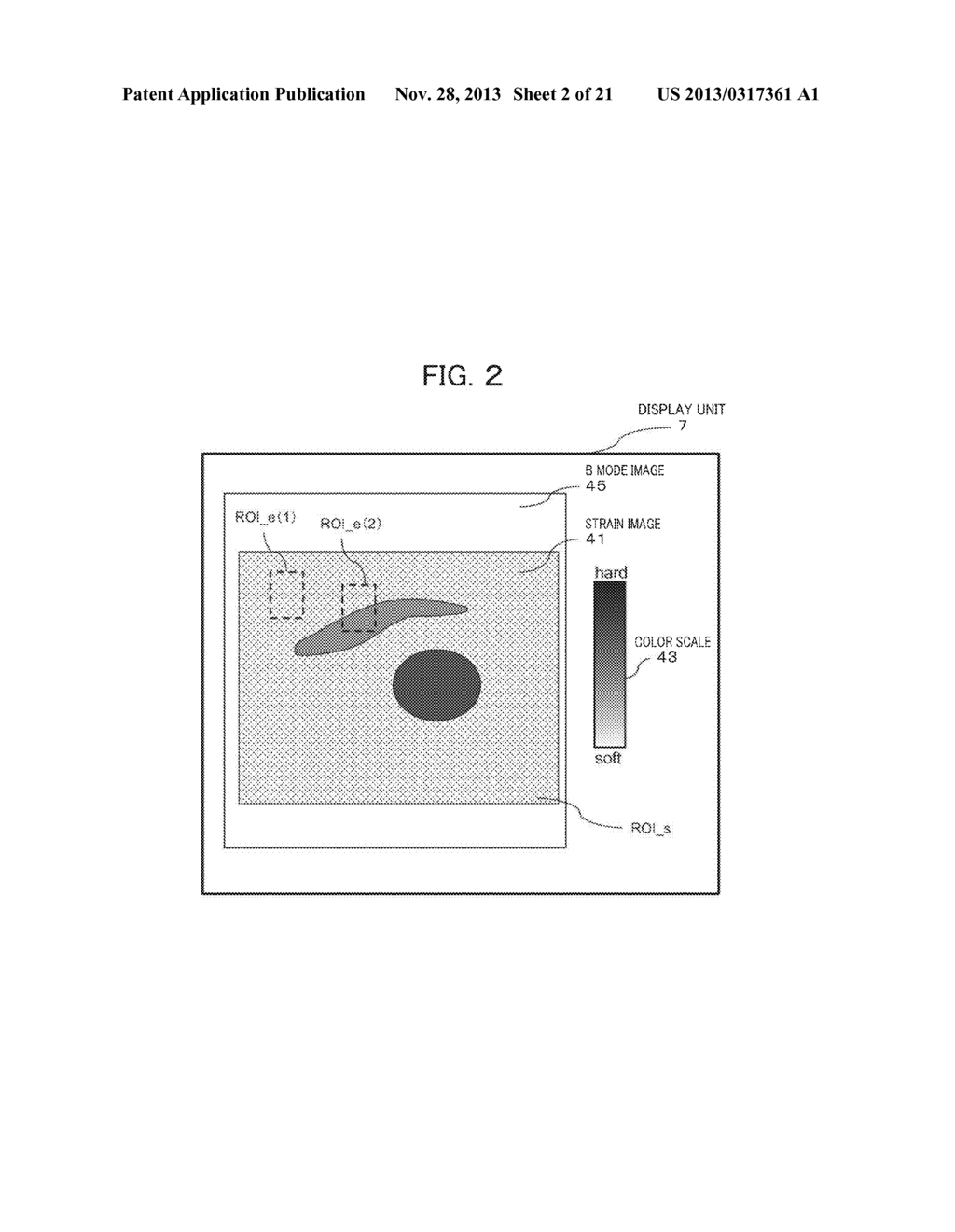 ULTRASOUND DIAGNOSTIC APPARATUS AND METHOD - diagram, schematic, and image 03