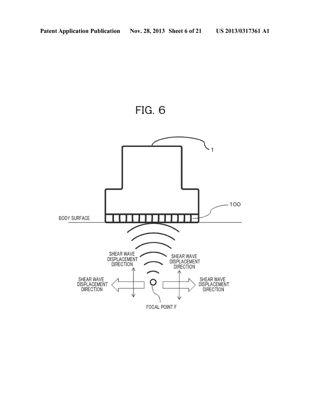 ULTRASOUND DIAGNOSTIC APPARATUS AND METHOD - diagram, schematic, and image 07