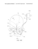 System for Mitigating the Effects of Tissue Blood Volume Changes to Aid in     Diagnosing Infiltration or Extravasation in Animalia Tissue diagram and image