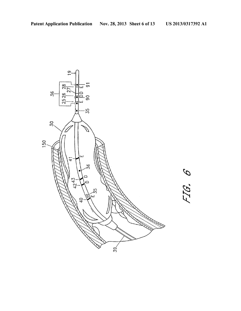 VALVE APERTURE SIZING DEVICES AND METHODS - diagram, schematic, and image 07