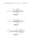 VALVE APERTURE SIZING DEVICES AND METHODS diagram and image