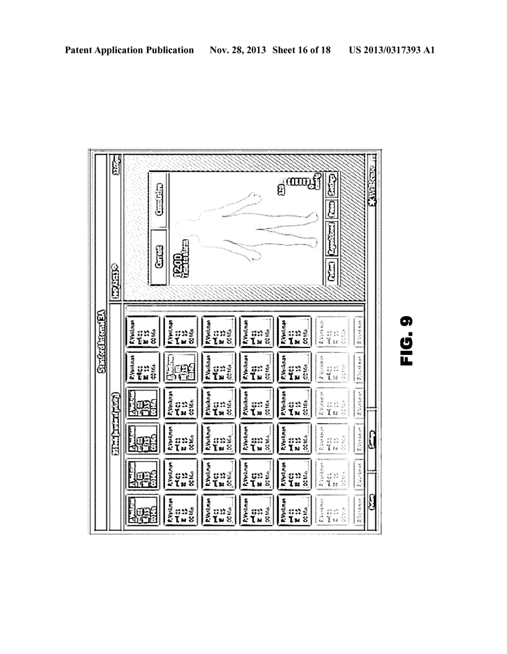 PRESSURE SENSOR ASSEMBLY AND ASSOCIATED METHOD FOR PREVENTING THE     DEVELOPMENT OF PRESSURE INJURIES - diagram, schematic, and image 17