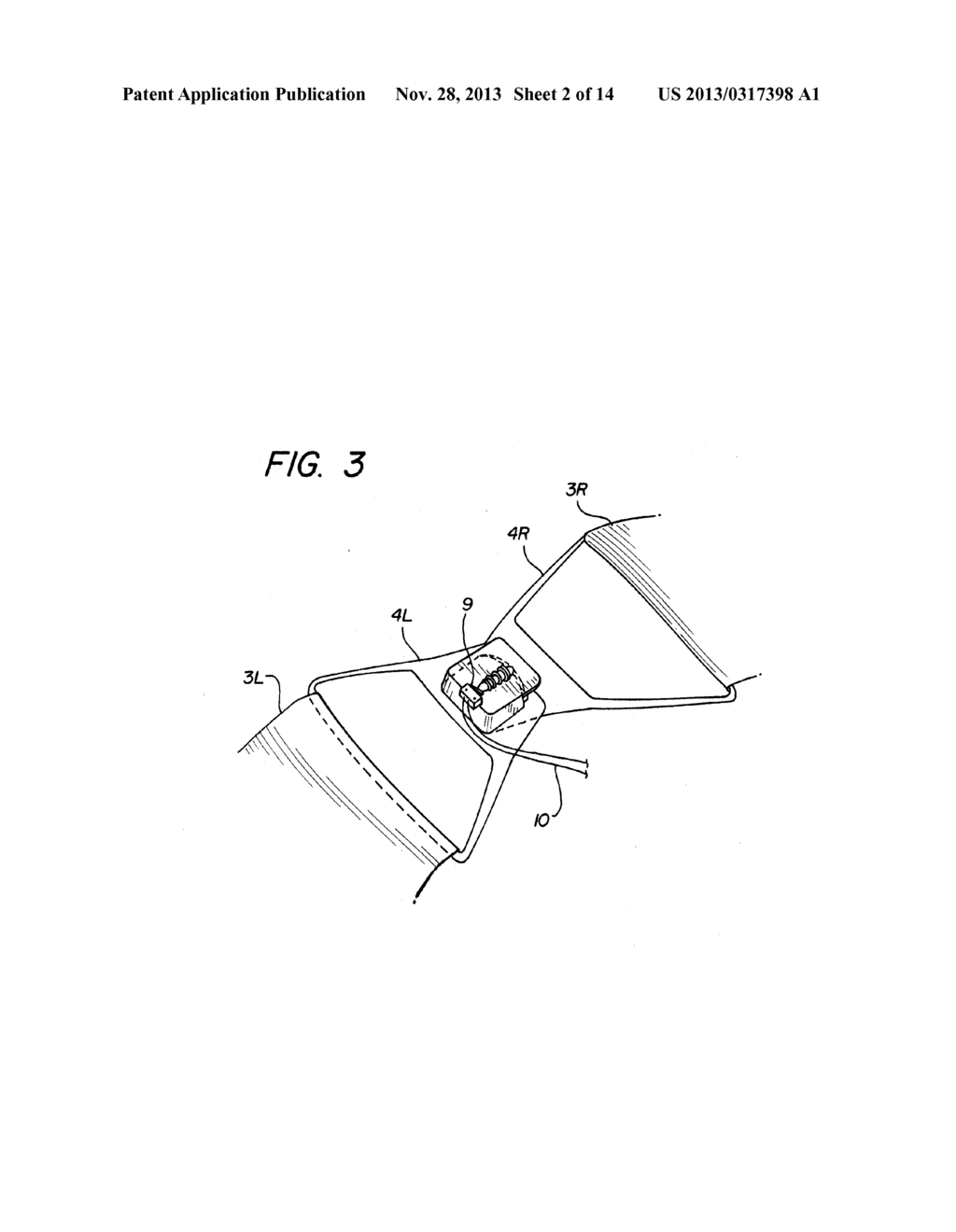 Resuscitation Device with Expert System - diagram, schematic, and image 03