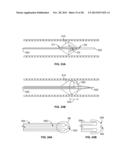 MULTI-LUMEN CENTRAL ACCESS VENA CAVA FILTER APPARATUS FOR CLOT MANAGEMENT     AND METHOD OF USING SAME diagram and image