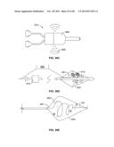 MULTI-LUMEN CENTRAL ACCESS VENA CAVA FILTER APPARATUS FOR CLOT MANAGEMENT     AND METHOD OF USING SAME diagram and image