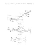 MULTI-LUMEN CENTRAL ACCESS VENA CAVA FILTER APPARATUS FOR CLOT MANAGEMENT     AND METHOD OF USING SAME diagram and image