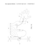 Dressing for an Insertion Site of an Intravascular Infusate diagram and image