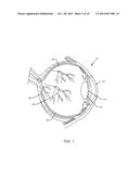 SYSTEM AND PROCESS FOR RETINA PHOTOTHERAPY diagram and image