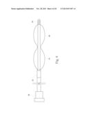 GERD TREATMENT APPARATUS AND METHOD diagram and image