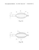 GERD TREATMENT APPARATUS AND METHOD diagram and image