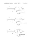 GERD TREATMENT APPARATUS AND METHOD diagram and image