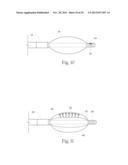 GERD TREATMENT APPARATUS AND METHOD diagram and image