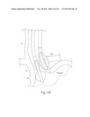 GERD TREATMENT APPARATUS AND METHOD diagram and image