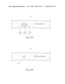 GERD TREATMENT APPARATUS AND METHOD diagram and image